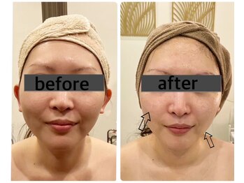 マリスレジーナ 新保店(MarisRegina)/コルギ