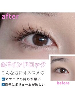 ステラ 松戸店(STELLA)/バインドロック