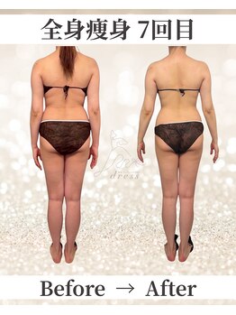 ドレス(dress)/全身痩身Before/After