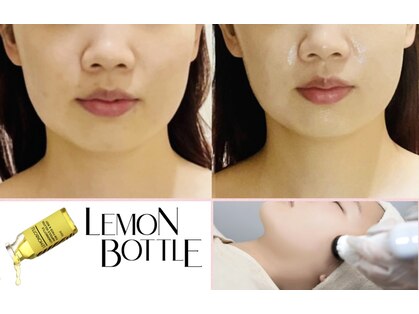 グレイスシャイン(GraceShine)の写真