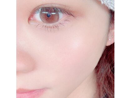 リノ(Lino)の写真