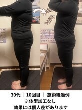 ヨサパーク リノ(YOSA PARK Lino)
