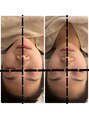 エマーチェ 自由が丘(emmace) 歪み改善に骨格矯正も是非お試しください♪