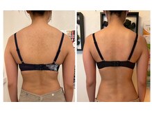 美人バスト 豊橋店/お背中もスッキリ【バストケア】