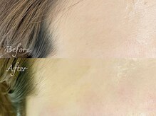 アンジェリック ウィング川崎店(Angelic)/額ワックス