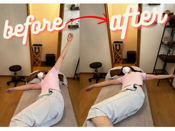 マーレ(MARE)/整体プログラムの効果