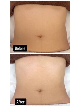 サロン ド レーヴ(Salon de Reve)/【お客様の事例】Billy’s Care