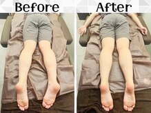 リストアハート(Restore Heart)/骨盤矯正