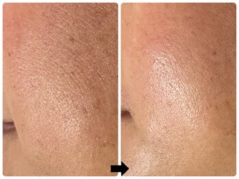 エフェクト 塚口店(effect)/Before After 40代/3回目