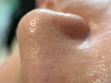 リセットプラス(Reset+)/