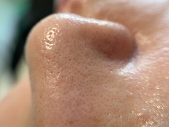 リセットプラス(Reset+)/