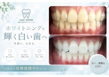 ノビシロホワイトニング(nobi-SHIROホワイトニング)