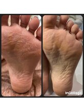 福屋。 指宿店/角質ケア