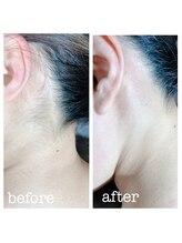 ルルゴ(LULUGO)/ワックス脱毛、うなじ～背中