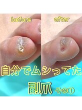 新宿巻き爪補正店/