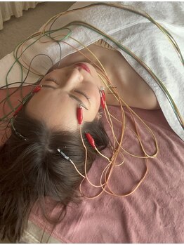 きよこのはり/電気を流す美容鍼