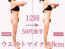 べモーレ 上本町 谷町九丁目(Bemolle)/50代痩身12回ビフォーアフター☆