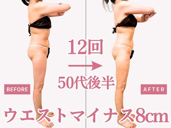 べモーレ 上本町 谷町九丁目(Bemolle)/50代痩身12回ビフォーアフター☆