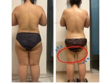 オーシャンブルーム 目黒(OceanBloom)/-9キロハイパーナイフ全身