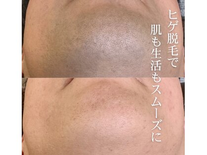 スキンスタジオトウキョウ(SKIN STUDIO TOKYO)の写真