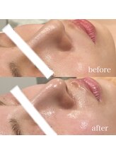 エヌ セレクション(N_selection)/毛穴はボンバークリームで解決！