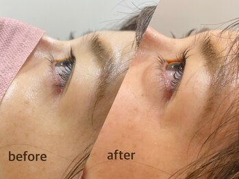 アール ヘッドスパ(R head spa)/【パリジェンヌ/まつげパーマ】