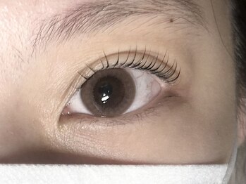 ソア 並木坂店(Soa)/まぶた持ち上げ効果☆ミ