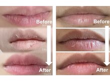 アブニールブリヨン/ローマピンク[シミくすみケア]