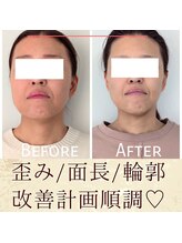 スウ(suu.)/Before-After【40代】9 回