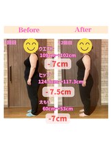 アネラフィット(ANELA Fit)/短期ダイエットモニター3か月