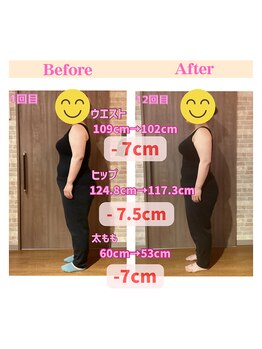 アネラフィット(ANELA Fit)/短期ダイエットモニター3か月