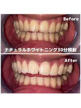 ライトビューティー 関内店(LIGHT BEAUTY)/[ 初めての方おすすめ ]