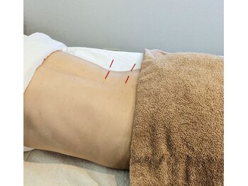 コンディショニングサロン クーラ(CURA)/鍼灸施術