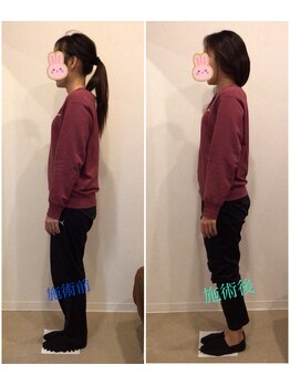 うちんだい整骨院 整体院/30代女性/骨盤矯正 施術事例