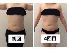 ナチュラル ユース(Natural youth)の雰囲気（1度でも変化あり◎継続で見違えたボディと健康的な身体へと変化!）