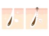*8月限定*毛穴レス肌を目指す◎毛穴洗浄&角質オフ&選べるパック ¥3,300