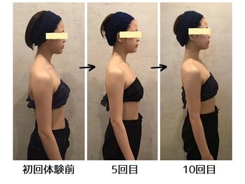 小顔フェイスラボ 難波店(小顔 Face Labo)/【姿勢改善】