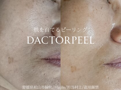メイプル(Maple)の写真