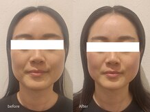 レジスタ(REGISTA)/【変えたのは骨じゃない】