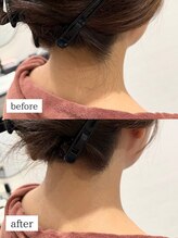 ワイズサロン(Y's salon)/うなじ脱毛