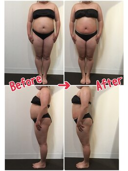 オージャス(OJAS)/30代○○さんの変化 痩ボディへ