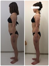 アミクール エステティックサロン(amicoeur)/ウエスト９センチ減りました♪