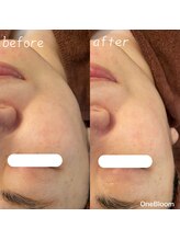 ワンブルーム(OneBloom)/緩んだ筋肉鍛えなおす！