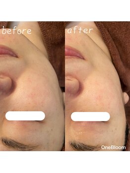 ワンブルーム(OneBloom)/緩んだ筋肉鍛えなおす!