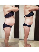 シャンティ(Shanti)/浜松市中区結果だし痩身専門店