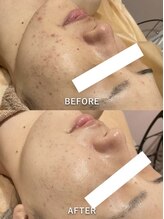 グランヴェルジェ(Granverger)/