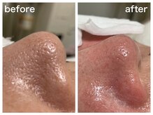 ダルセーニョ/【論より証拠！】１回目