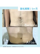 メンズクリア 四日市近鉄百貨店/【メンズクリア】お客様の施術例