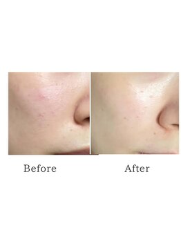 サロン リノ(salon rino)/