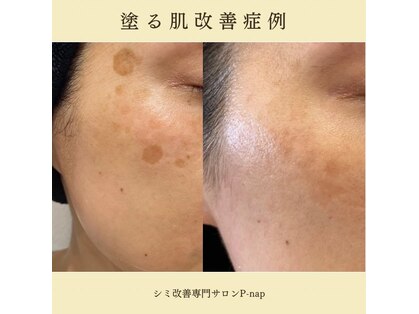 ピーナップ(P-nap)の写真